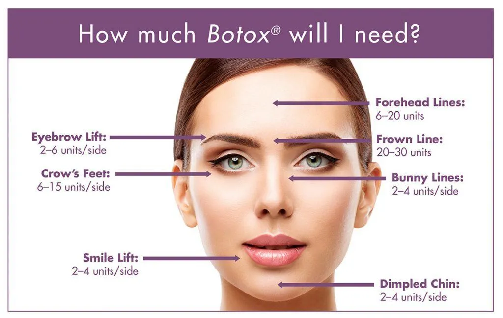 Botox Crow's Feet