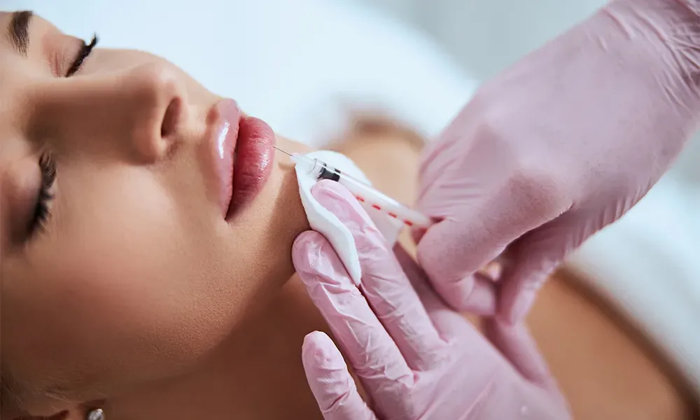Lip Filler